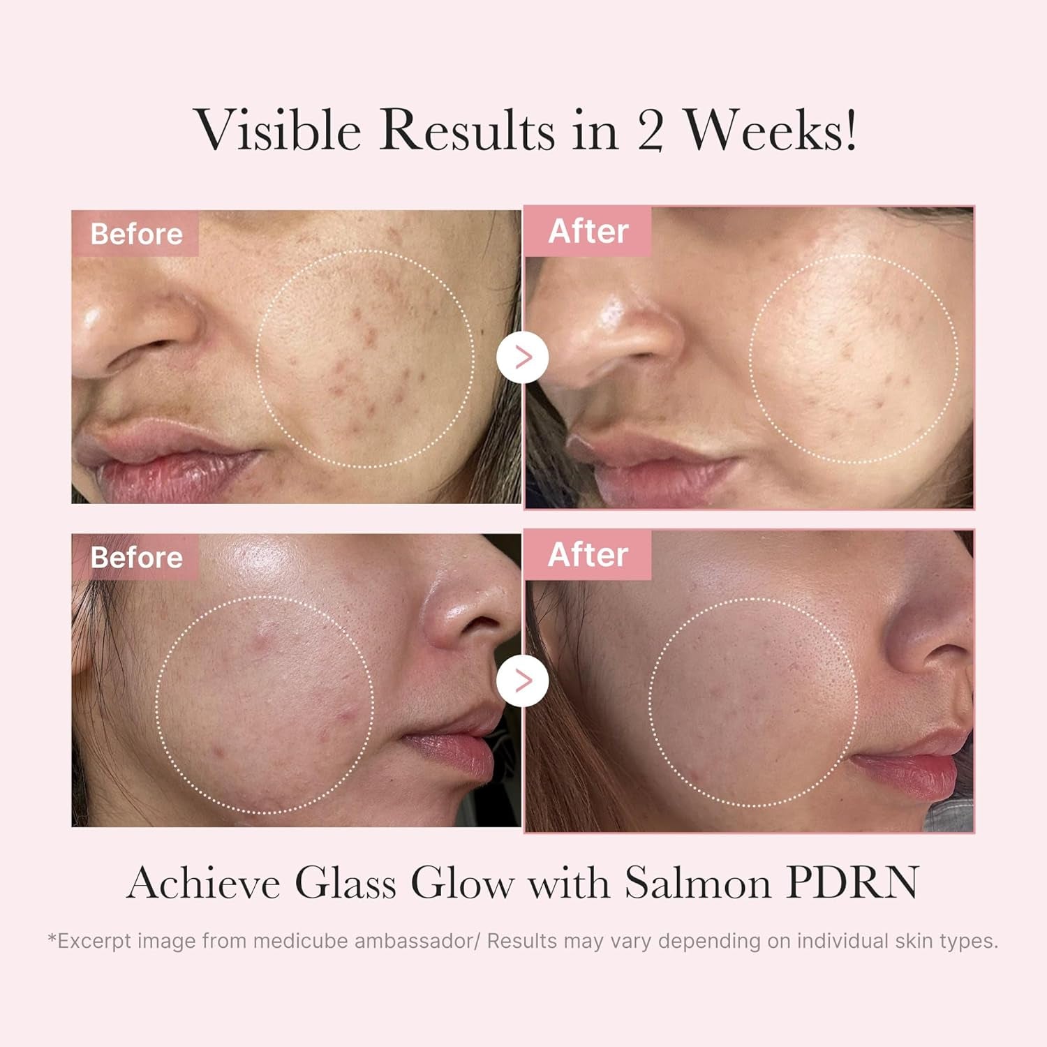 Medicube Salmon DNA PDRN Trial Kit | Glass Glow Mini Skincare Set with Toner, Se